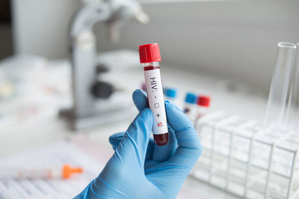Dinkes Sulteng Catat 3.989 Orang Positif HIV hingga Agustus 2026, Sebanyak 1.718 Belum Jalani Terapi